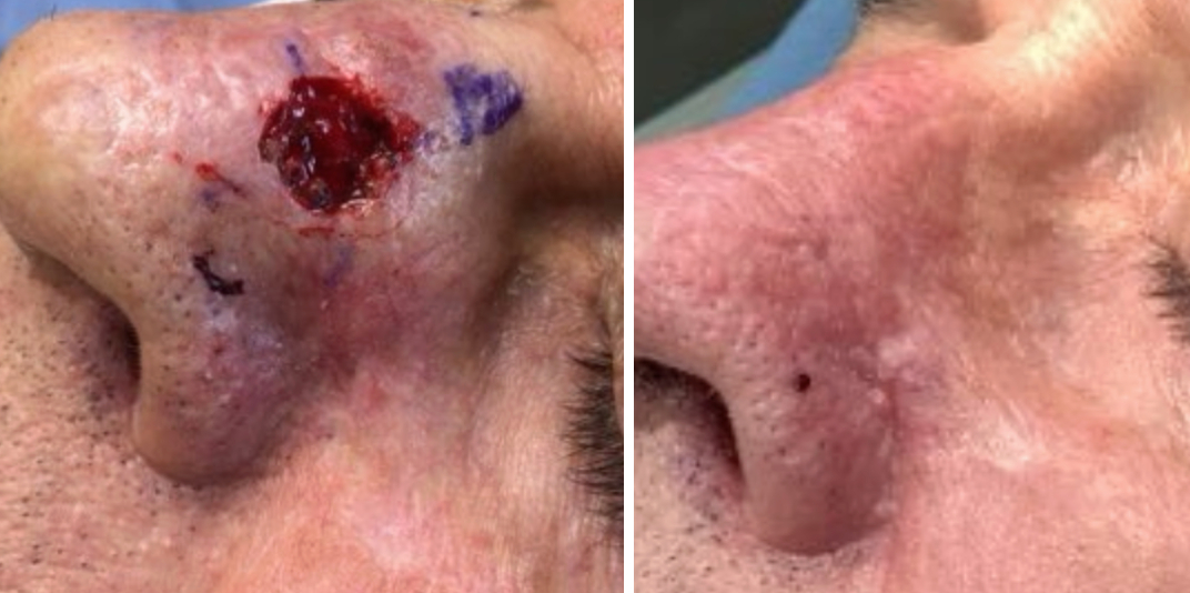 Before & After Photo Disclaimer