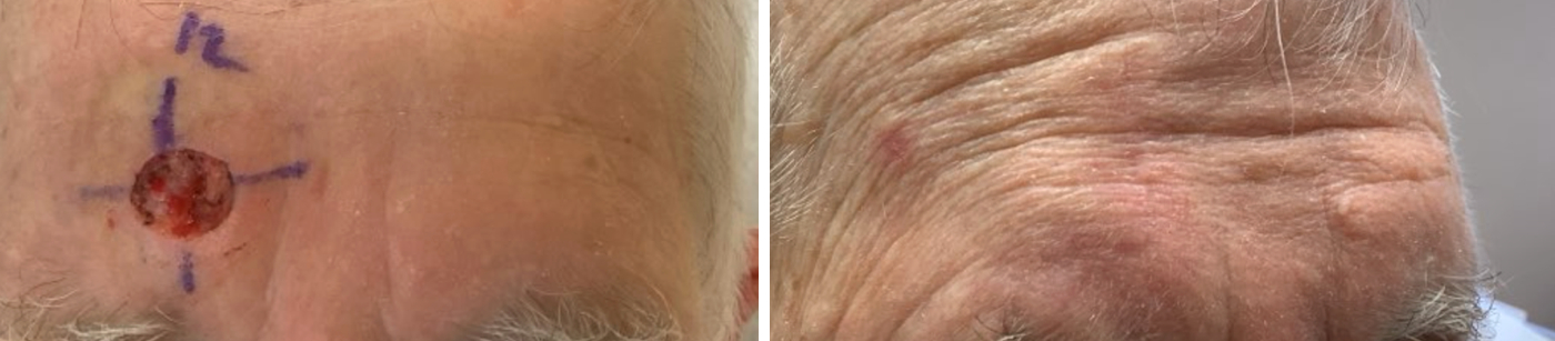 Before & After Photo Disclaimer