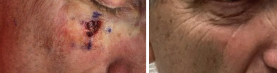 Before & After Photo Disclaimer