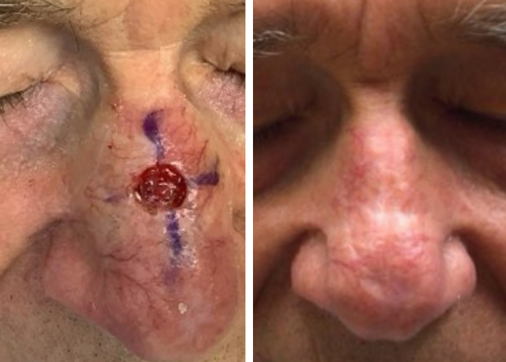 Before & After Photo Disclaimer